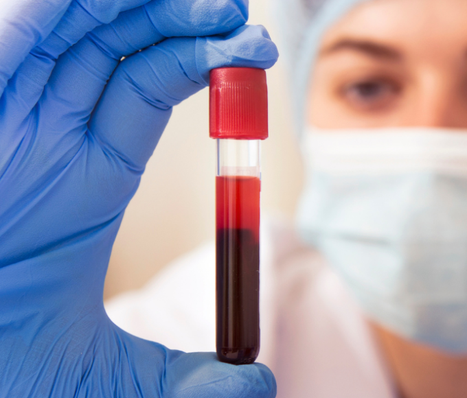Exame sangue